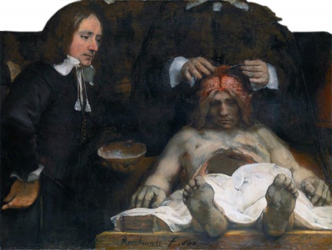 Dr_Deijman’s_Anatomy_Lesson_(fragment),_by_Rembrandt